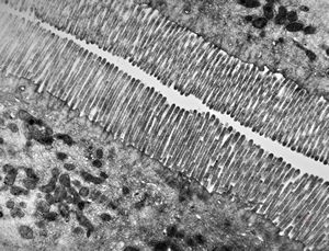 normal mucosa - jejunum - microvilli